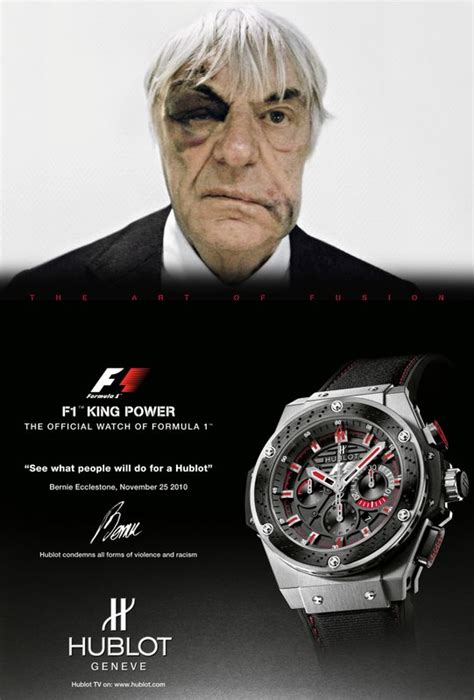 hublot black eye ad|Bruised and battered Bernie Ecclestone in Hublot ad .